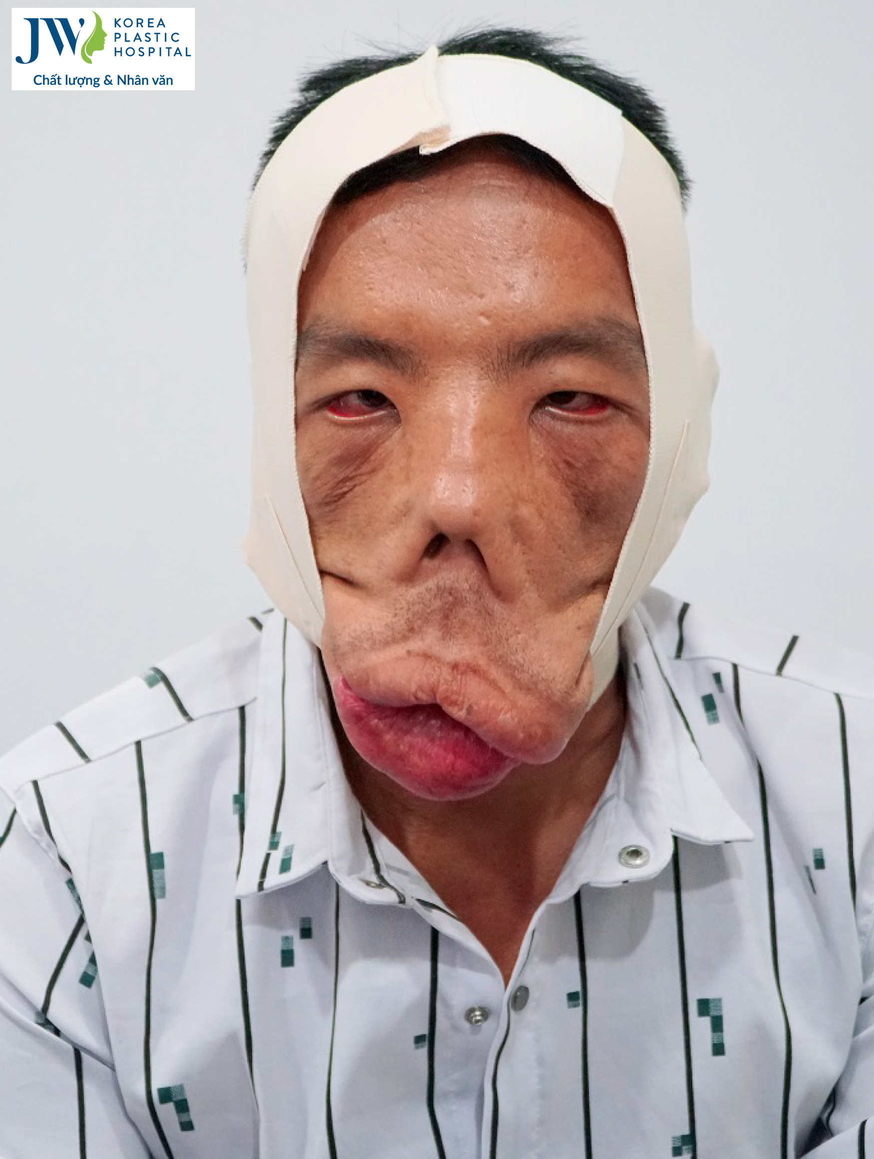 bac-si-tu-dung-tang-anh-men-dai-deo-mat