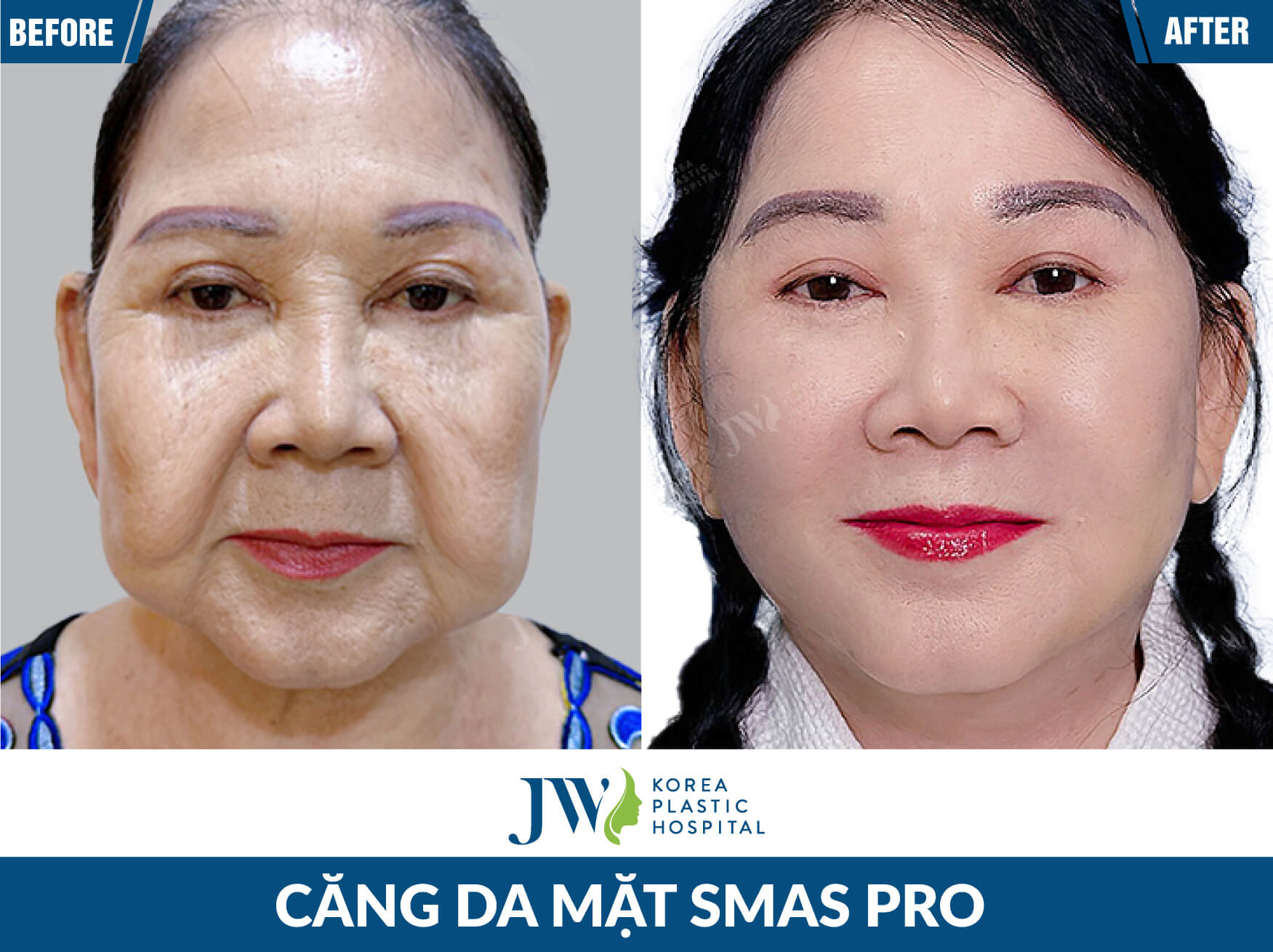 cang da mat tai jw