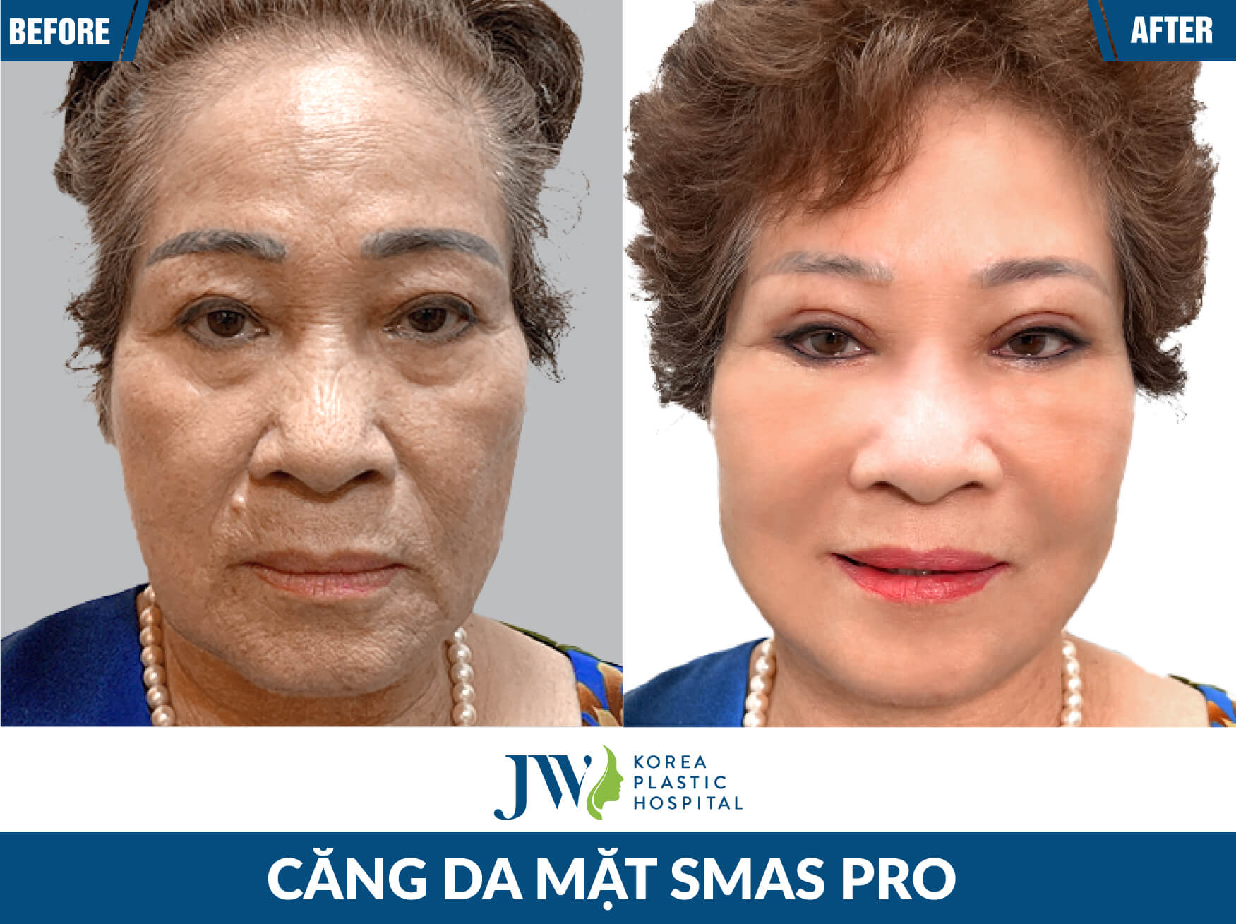 cang-da-mat
