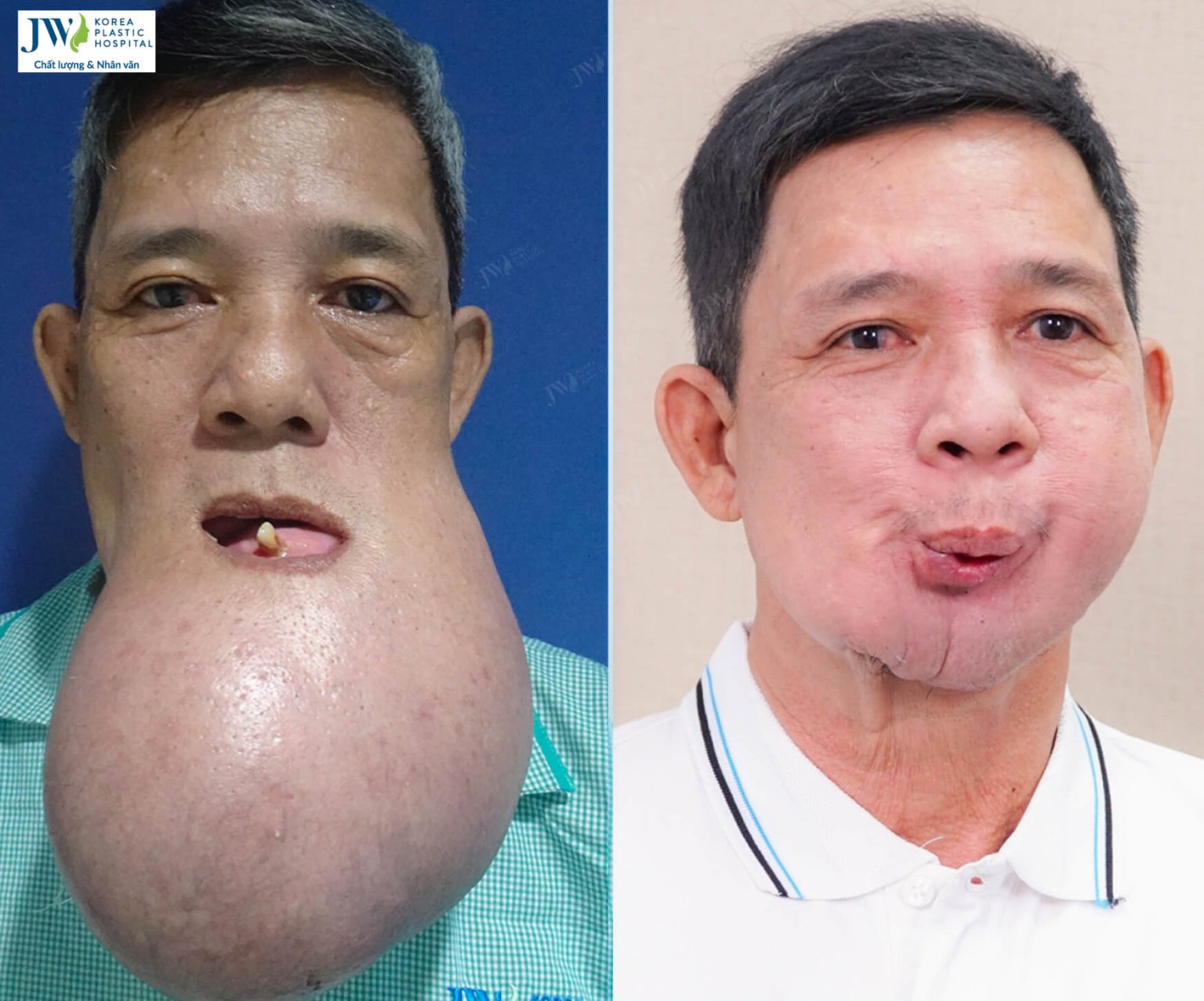 chu-khanh