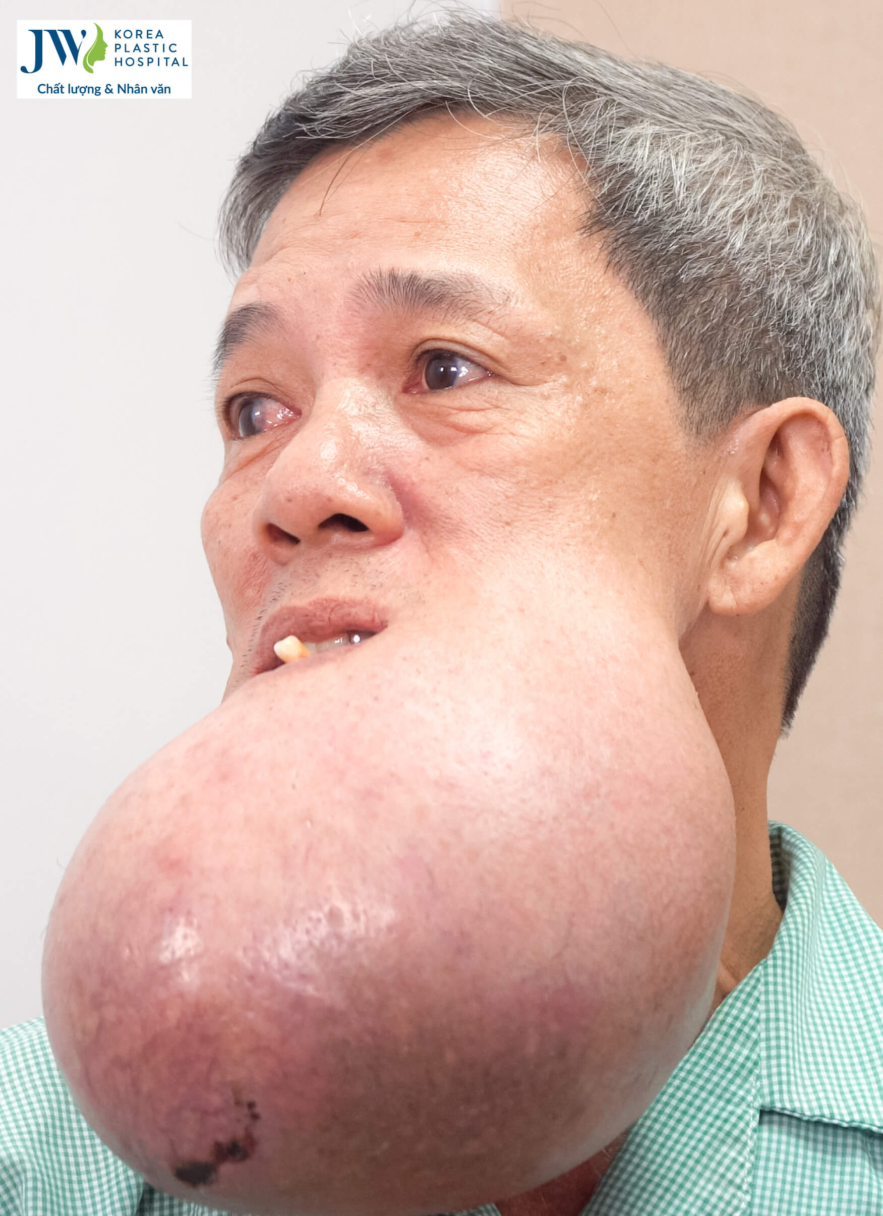 chu-khanh-khoi-u-khong-lo