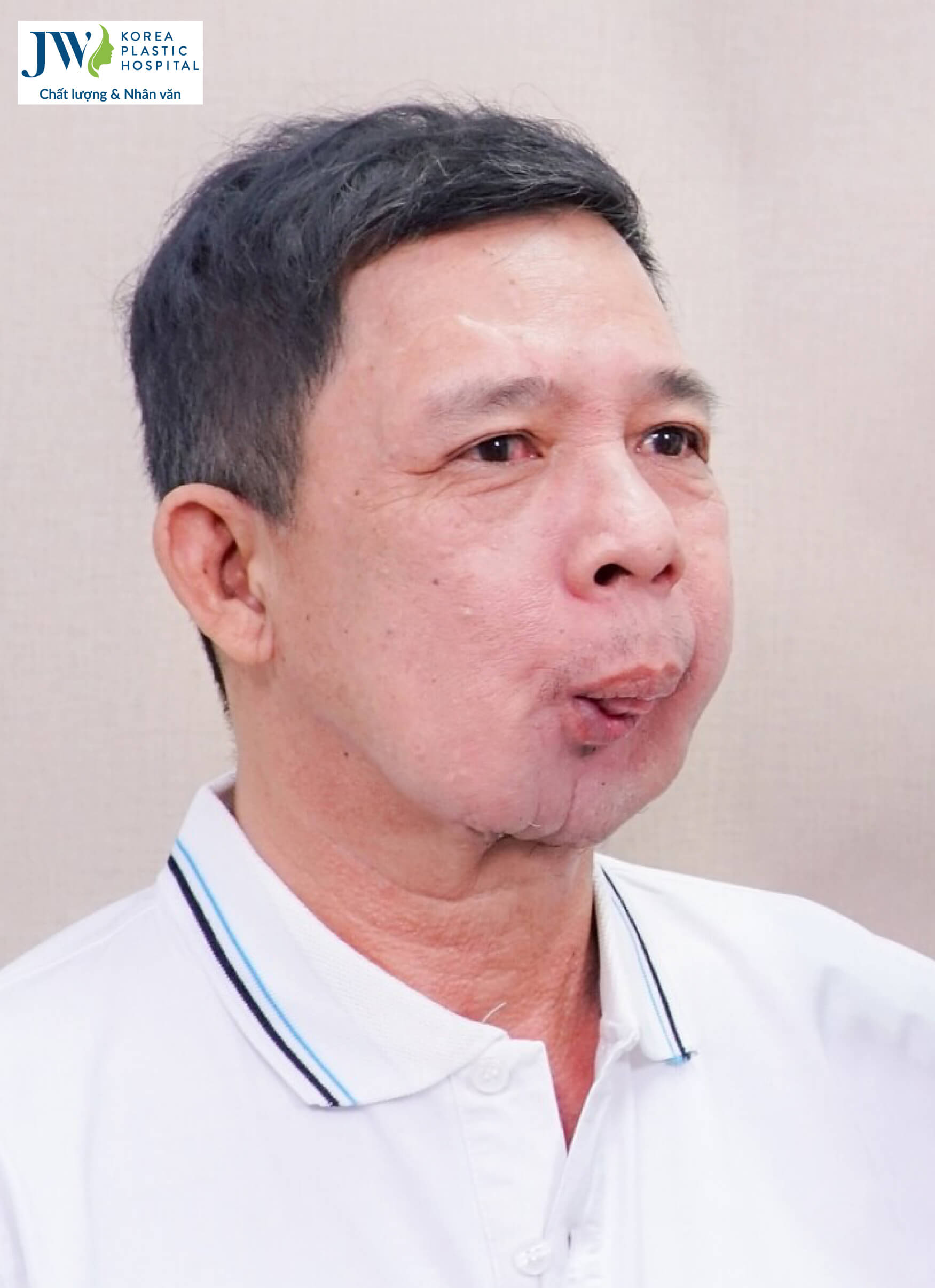 chu-khanh-sau-khi-dieu-tri