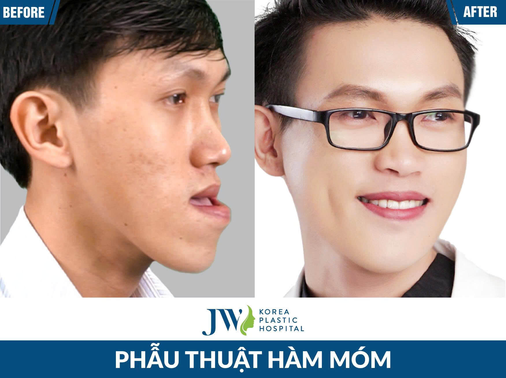 ham-mom