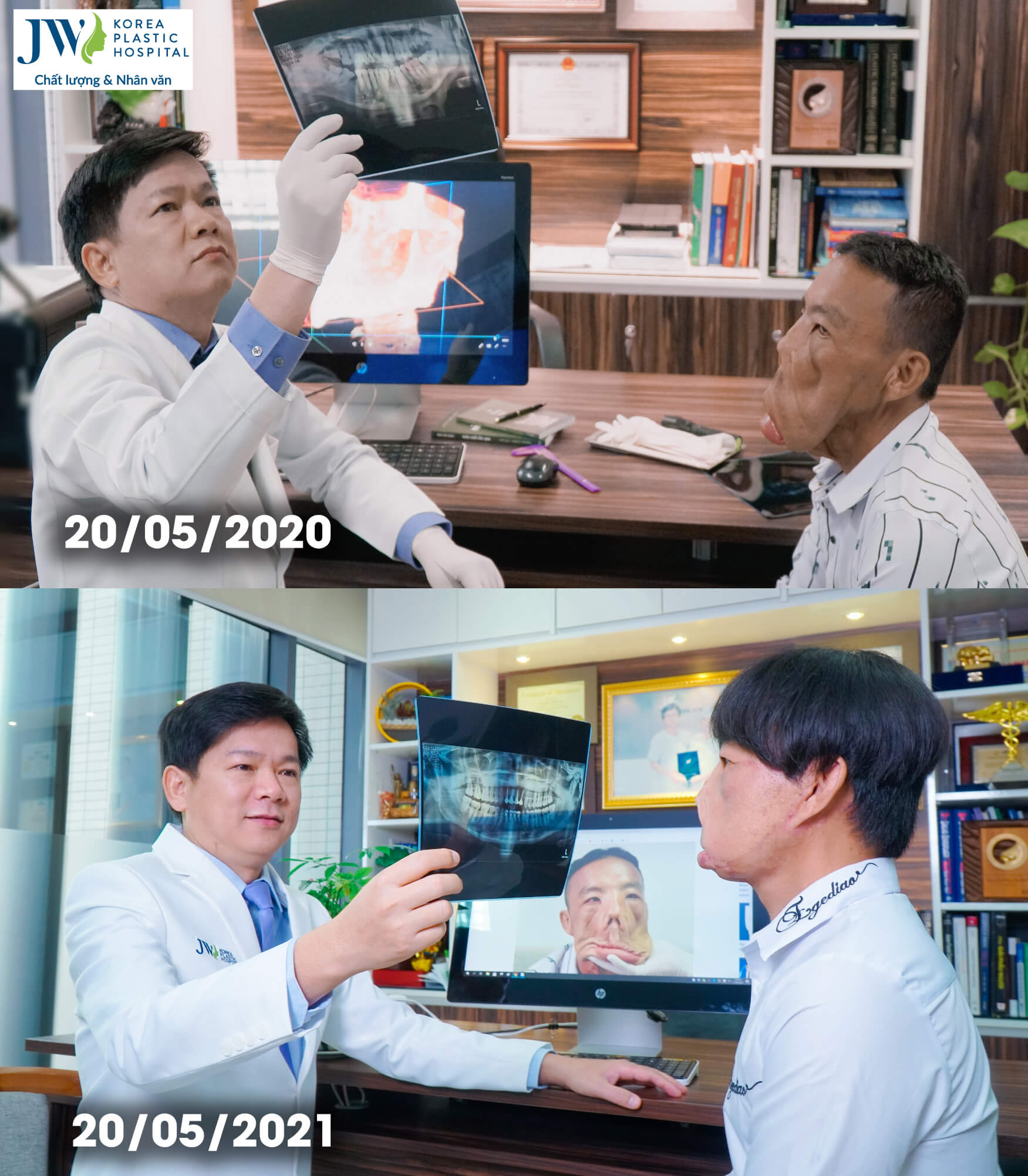 sau-365-ngay-dieu-tri-cho-anh-men