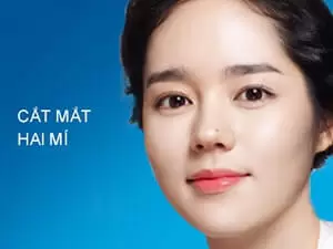 Cắt mắt hai mí