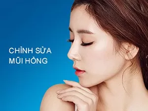 Chỉnh sữa mũi hỏng