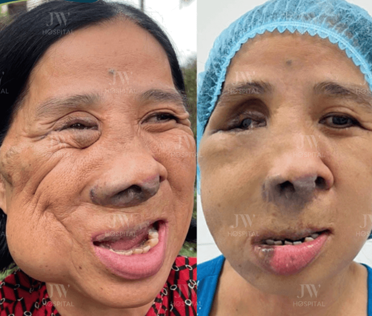 cô màng miền tây u kéo xệ nửa gương mặt