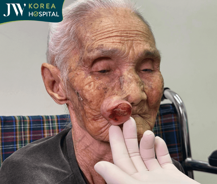 cụ bà 100 tuổi lần đầu gặp bác sĩ Tú Dung