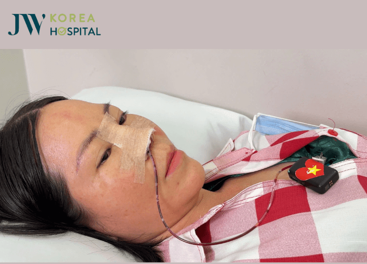 hút dịch mũi sau phẫu thuật