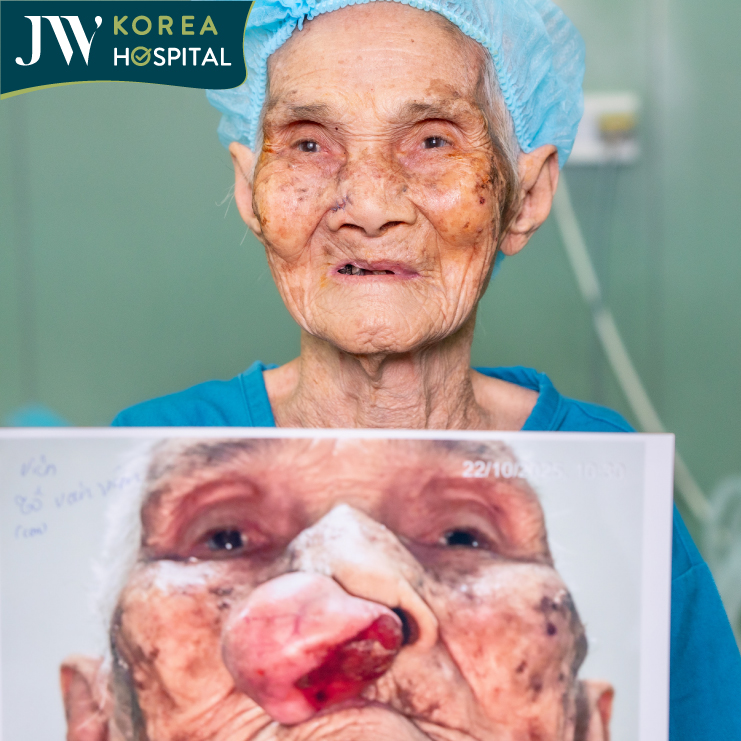 Hình ảnh trước và sau của cụ Khoan sau ca phẫu thuật cắt bỏ khối u mạch máu 