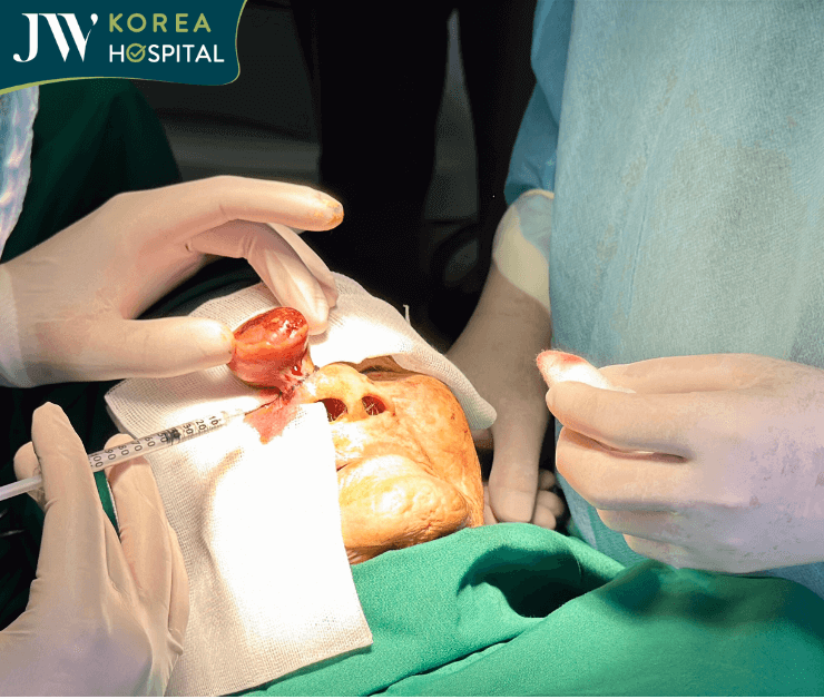 tiến hành phẫu thuật cắt khối u cho cụ