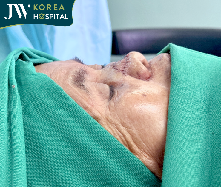 góc nghiêng sau khi phẫu thuật của bà sư