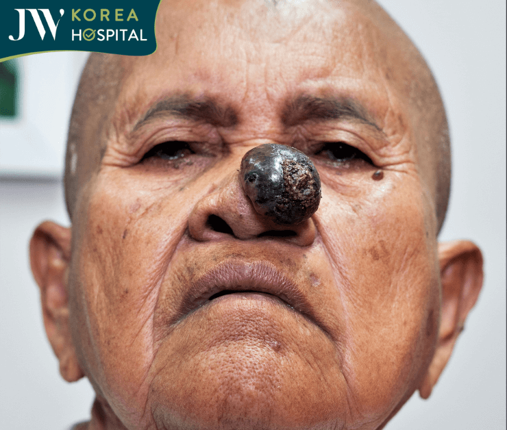 Khối u ác tính của Sư bà khi đến cầu cứu bác sĩ Tú Dung