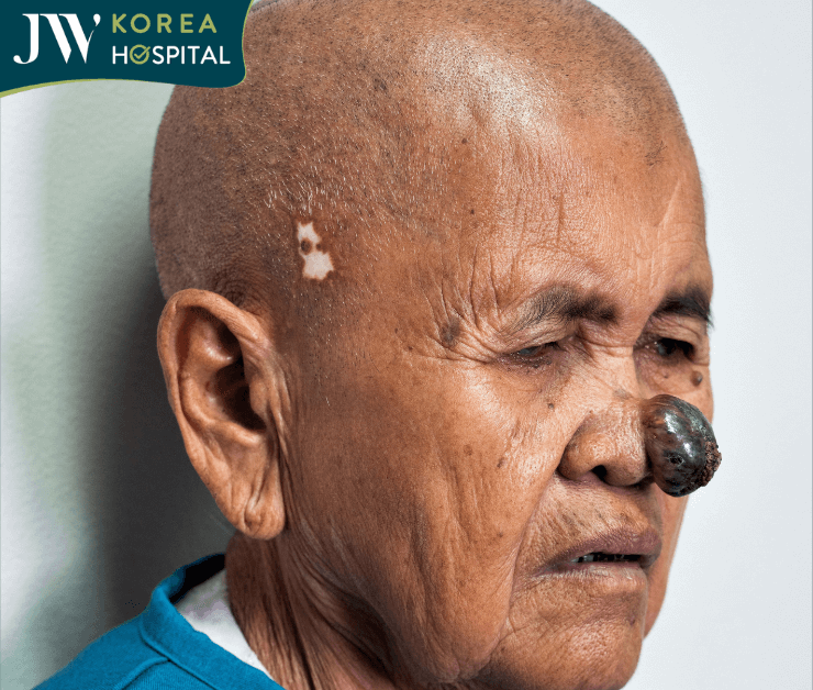 khối u ác tính của sư bà đến cầu cứu bác sĩ Tú Dung