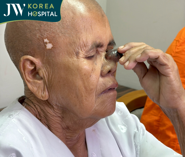 sư bà khơ-me chạm tay vào khối u