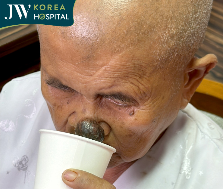 sư bà khơ-me gặp khó khăn khi sinh hoạt