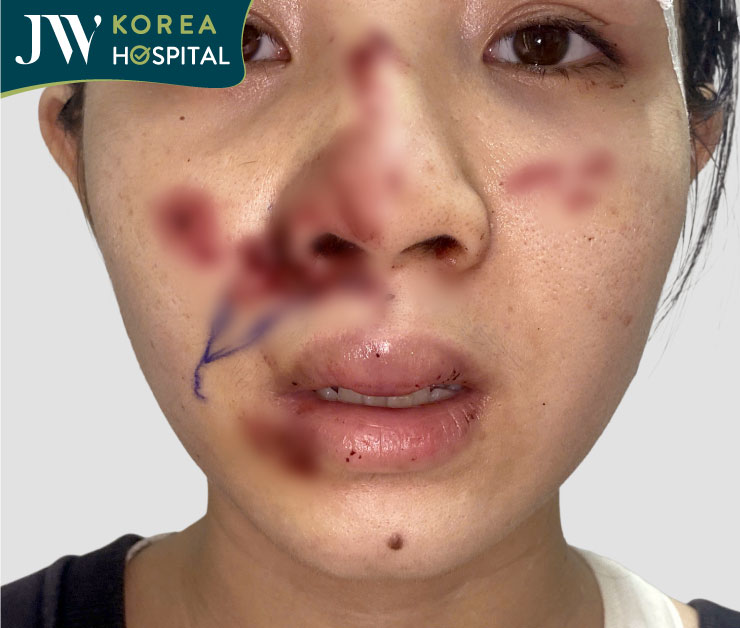 cận cảnh gương mặt cô gái bị tai nạn giao thông do chó thả rong