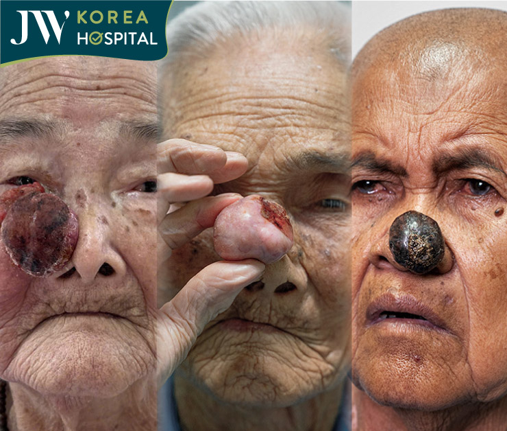 các ca mỗ miễn phí tại bệnh viện đa khoa jw