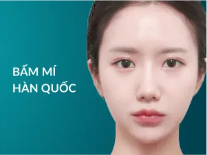 Bấm mí hàn quốc