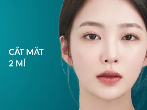 Cắt mắt hai mí