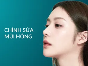 Chỉnh sữa mũi hỏng