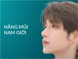 Nâng mũi nam giới