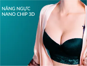 Nâng ngực nano chip 3D