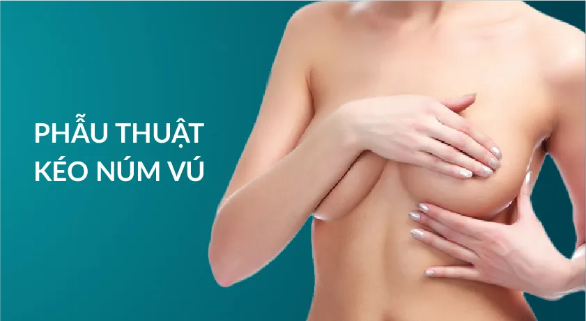 Phẫu thuật kéo núm vú
