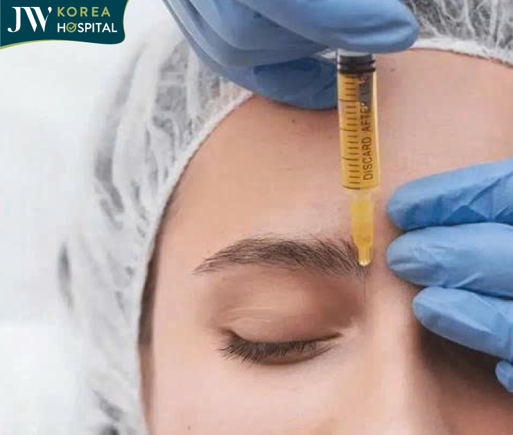 minh họa tiêm mesotox