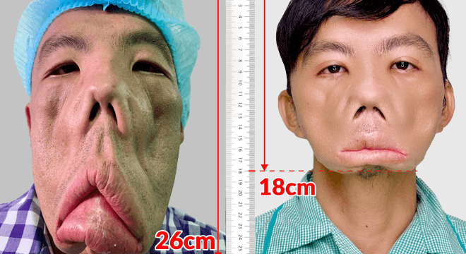 khach-hang-01-anh-men