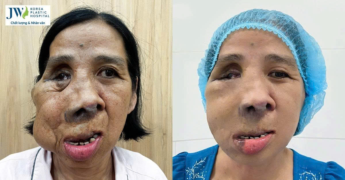 cô Màng