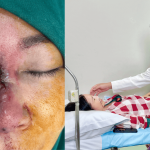 Kỳ tích y khoa: Bác sĩ Tú Dung cứu sống người phụ nữ hoại tử mũi sau khi chi 65 triệu “đổi vận”