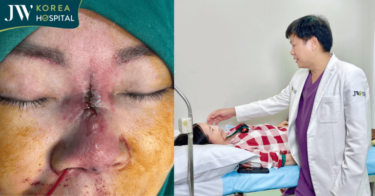 Kỳ tích y khoa: Bác sĩ Tú Dung cứu sống người phụ nữ hoại tử mũi sau khi chi 65 triệu “đổi vận”