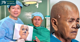 Sư bà Khơ-me sau khi phẫu thuật cắt khối U