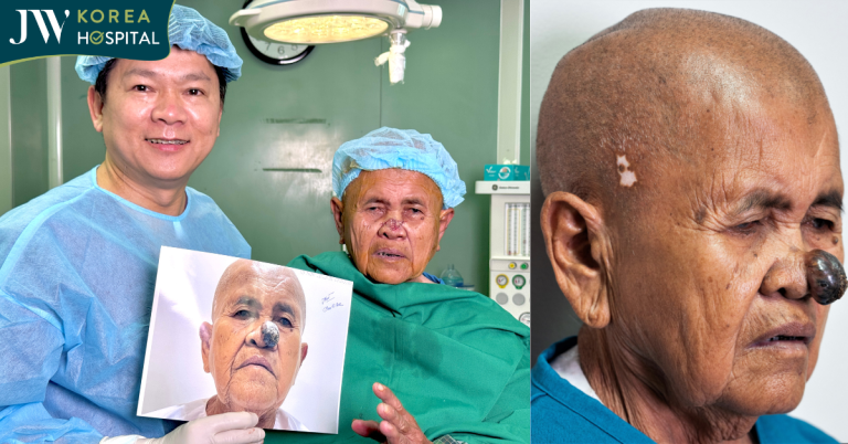 Bác Sĩ Tú Dung Mổ Miễn Phí Cứu Sư Bà Khơ-Me 80 Tuổi Mang Khối U Hoại Tử Nguy Hiểm Trên Mặt