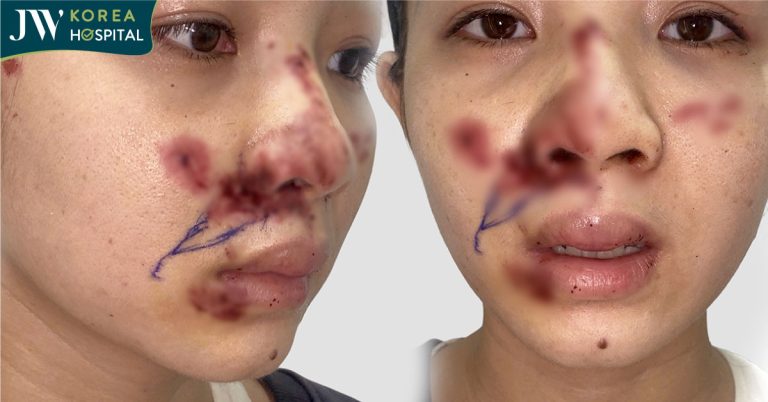 Bác sĩ Tú Dung xử lý ca tai nạn giao thông nghiêm trọng